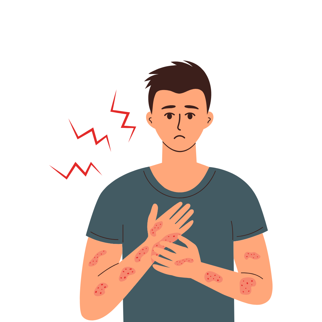 Irritation